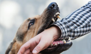 Dog Bites
