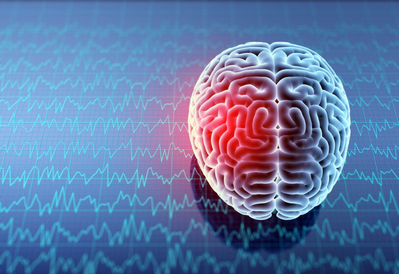 What Is CTE?